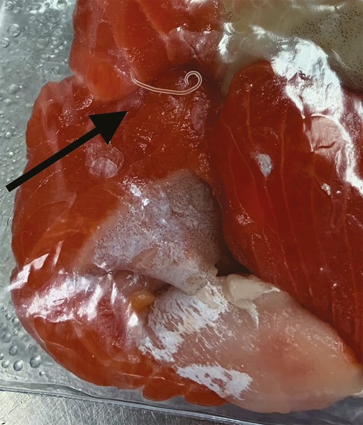 A piece of sockeye salmon was submitted to Cadham Provincial Laboratory for parasitic analysis. Visualization of the salmon with the naked eye revealed a white nematode larva approximately 22 mm long and 0.3 mm wide, consistent with an L3 larva of the Anisakis simplex complex. Pseudoterranova larvae, which are rarely found in salmon, are yellow–brown in color and larger than those of Anisakis, extending to 50 mm in length and 1.2 mm in width.