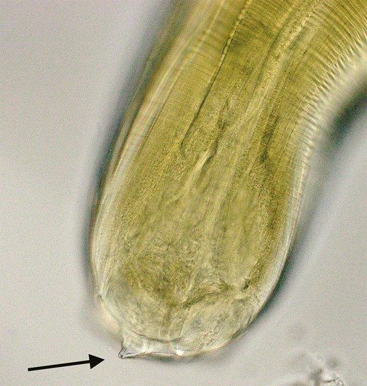 Larva removed from the salmon was treated with lactophenol solution for 5 minutes to clear debris and highlight anatomical structures. Examination of the cephalic end with light microscopy (40× objective lens) demonstrates the boring tooth used to penetrate the gastric and intestinal mucosa.