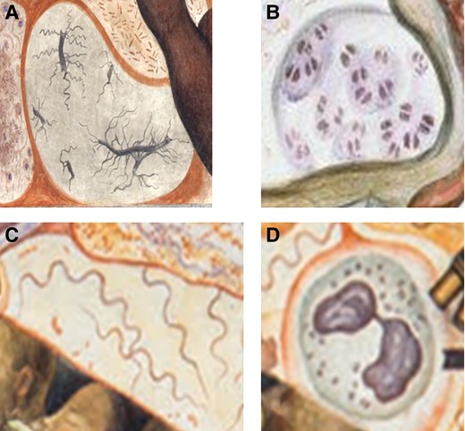 Some bacteria depicted in Rivera's frescoes. A, Salmonella Typhi. Detail from Figure 1A, Microbial Flora, Ministry of Health, Mexico City. B, Neisseria gonorrhoeae. Detail from Figure 3A, Detroit Industry, Detroit Institute of Art, Detroit. C, Treponema pallidum. Detail from Figure 4, Man, Controller of the Universe, Palacio de Bellas Artes, Mexico City. D, Polymorphonuclear leukocyte with intracellular cocci, perhaps Staphylococcus aureus or Streptococcus pneumoniae. Detail from Figure 4, Man, Controller of the Universe, Palacio de Bellas Artes, Mexico City. Reproduced with permission of Banco Mexico Diego Rivera Trust, Mexico, DF/Artists Rights Society, New York.