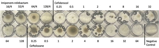 Acinetobacter baumannii complex isolate #9 demonstrating the paradoxical effect with cefiderocol by reference broth microdilution testing. Growth is observed at 0.25–0.5 µg/mL with no growth at 1–2 µg/mL and the reappearance of growth at 4 µg/mL, with increasing strength of growth as the doubling dilutions increase up to 128 µg/mL. Growth at 64 µg/mL and 128 µg/mL are diffuse throughout the wells. This observation was repeated by triplicate testing. Bubbles are observed in most wells and should be ignored.