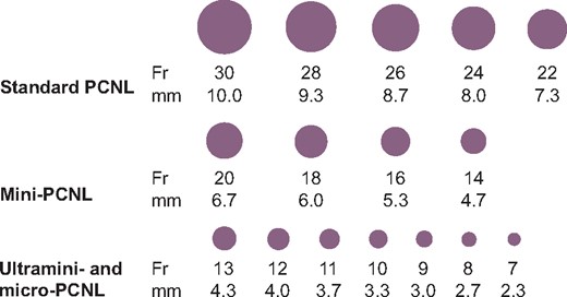 Sheath sizes for different PCNL types. The different types of PCNL differ in the size of the sheath used to access the kidney. An illustration of the different sizes in each type can be seen for comparison. The most common sizes used are 30 Fr for standard PCNL and 16 Fr for mini-PCNL (ultramini- and micro-PCNL are rare and there is no consensus regarding common practice).