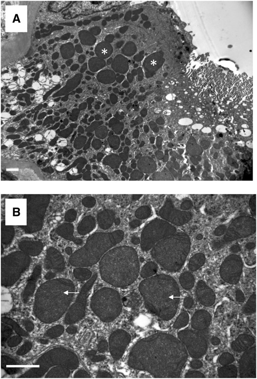 Representative images of transmission electron microscopy showing (A) enlarged and irregular mitochondria (white stars) and (B) disappearance of mitochondrial ridges (white arrows). Scale bar, 1 µm.