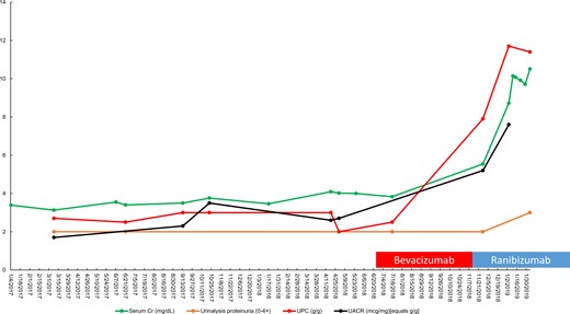 Trend of serum Cr, urinalysis proteinuria, urine protein/Cr ratio and urine albumin/Cr ratio for Patient 1 versus date. Red box, bevacizumab administration; blue box, ranibizumab administration. UPC, urine protein/Cr ratio.