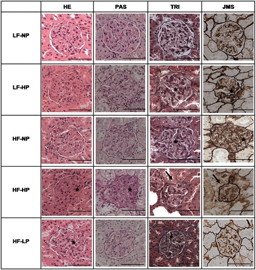 Glomerular lesions in kidney samples stained with HE, PAS reagent, TRI and JMS in rats fed diets with LF–NP, LF–HP, HF–NP, HF–HP and HF–LP. InLM, the group LF–NP did not show evident glomerular changes. Increased percentage of retracted glomeruli (asterisks) was observed in LF–HP and the HF groups, with a decrease in the urinary space, obliteration of capillary loops and thickening of the basal membrane. Glomerular sclerosis (arrow), with a marked reduction in glomerular size, retraction of capillary loops, mesangial expansion and thickening of Bowman’s capsule and basal membrane, was more severe in the HF–HP group. Scale bar: 50 µm.