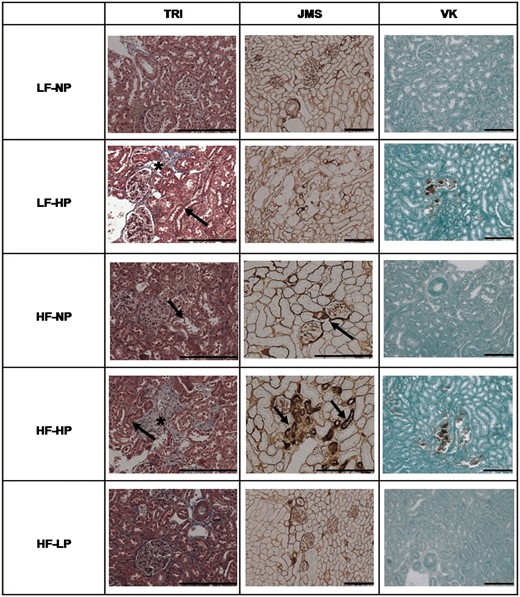 Tubular and interstitial lesions in kidney samples stained with TRI, JMS and VK staining in rats fed diets with LF–NP, LF–HP, HF–NP, HF–HP and HF–LP. No lesions were observed in kidneys of LF–NP rats. In HF and HP, mild nephropathy (arrow) with tubular hyperplasia, tubular atrophy and thickening of the basal membrane was observed. Mineral deposits were observed only in HP groups and they were depicted by brown color in VK stain. Interstitial fibrosis (asterisks) was more evident in HP groups than in the NP and LP groups. Scale bar: 200 µm.