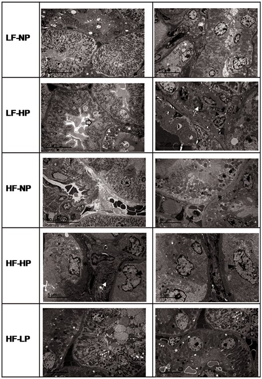 Tubular and interstitial lesions observed by TEM in rats fed diets with LF–NP, LF–HP, HF–NP, HF–HP and HF–LP. In ultrastructure, the HF and HP groups showed focal tubular changes. Tubules with thickened basal membrane (asterisks), tubular hypertrophy (arrow head), hyperplasia (grey arrow), focal collagen deposits and inflammatory cells (arrow) were observed.