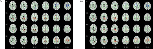The differences of DTI measures. (a) ESRD-ND versus HCs. (b) ESRD-HD versus HCs. Green represents the mean FA skeleton of all subjects, blue shows regions with decreased FA (1st row) compared with HCs and red shows regions with increased MD (2nd row), AD (3rd row) and RD (4nd row) compared with HCs. The number below the brain image indicates the Z coordinate in the Montreal Neurological Institute (MNI) space.