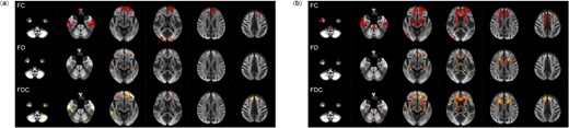 Whole-brain results for FBA. (a) ESRD-ND versus HCs. (b) ESRD-HD versus HCs. Fiber tract–specific significant decreases are displayed in axial slices.
