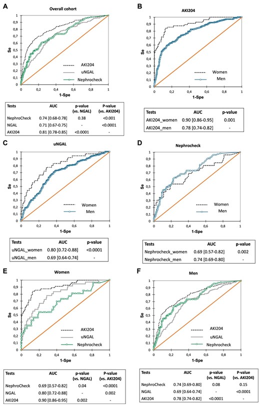Performances of urinary biomarkers to predict AKI in a cohort of CBP surgery patients (receiver operating characteristics curves analysis). (A) Overall cohort, all biomarkers (AKI204 versus uNGAL, P < .001; AKI204 versus NephroCheck, P < .001; uNGAL versus NephroCheck, P = .38. Men and women assessed separately for (B) AKI204 (P < .001), (C) NephroCheck (P = .002) and (D) uNGAL (P < .001). (E) Men, all biomarkers (AKI204 versus uNGAL, P < .001; AKI204 versus NephroCheck, P = .15; uNGAL versus NephroCheck, P = .08). (F) Women, all biomarkers (AKI204 versus uNGAL, P = .002; AKI204 versus NephroCheck, P < .001; uNGAL versus NephroCheck, P = .04).