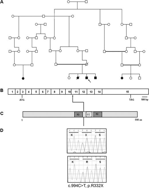 Molecular genetic diagnosis of NPHP5/IQCB1 mutation in a consanguineous Iranian family with SLS. (A) The consanguineous Iranian pedigree with SLS is shown. Circles represent females, whereas squares represent males. The index case is arrowed. Filled symbols denote presence of SLS. (B) Exon structure of NPHP5/IQCB1 drawn relative to scale bar with ATG start codon and TAG stop codon marked. (C) Representation of protein motifs of nephrocystin-5 with predicted protein domains IQ and coiled-coil (marked CC). (D) Sequence traces (nucleotides and respective codons) are shown for affected individuals (top) and healthy controls (bottom). The homozygous mutation c.994C>T results in the non-sense mutation p.R332X.