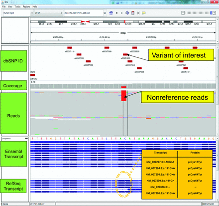 The top panel displays a chromosome ideogram with a red block highlighting the region being displayed in the lower panels. The genomic coordinates beneath the ideogram describe the precise genomic location of the current view. In this case, the view spans a 61-bp window, ∼41 Mb into chromosome 17 at q21.31. Beneath the coordinates, 5 separate data tracks are displayed. The first track contains the positions and IDs of dbSNP entries. Below these are the depth of coverage and read alignment tracks for a single biological sample. Note the colored regions in the read alignment track, which represent nucleotides that differ from the hg19 reference; in this case showing a C>T transition. Exonic structure of transcripts derived from the RefSeq and Ensembl databases are displayed in the lower panels. The HGVS nomenclature for the highlighted variant is c.191G>A (p.Cys64Tyr) or c.50G>A (p.Cys17Tyr), depending on the transcript affected. Such discrepancies have the potential to confuse variant interpretation particularly in instances where data are inappropriately collapsed and summarized as a single amino acid change, potentially omitting predictions of pathogenicity. Note, the HGVS nomenclature is represented as G>A rather than C>T because this gene is oriented on the reverse genomic strand.