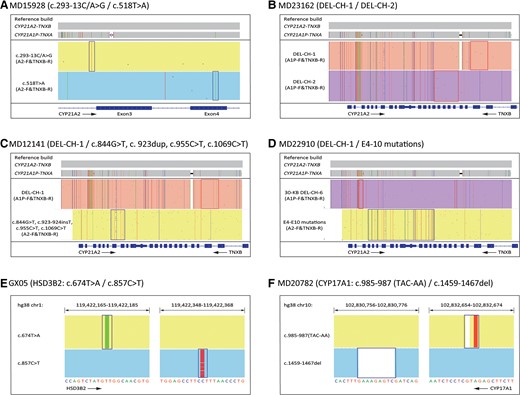 IGV plots of CACAH results showing variations of CAH genes. (A), Representative sample with CYP21A2 pathogenic SNV/indels; (B), representative sample with CYP21A2 gene deletions; (C), sample MD12141 with CYP21A2 complex variations; (D), sample MD22910 with CYP21A2 complex variations; (E), sample GX05 with HSD3B2 gene variations; (F), sample MD20782 with CYP17A1 gene variations. The boxes highlighted the pathogenic SNV/indels identified in figure A, E, and F, lower panel of figure C and D, and the boxes indicated junction sites of 30-kb deletions in figure B, upper panel of figure C and D.