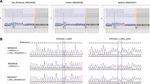 MLPA and Sanger sequencing analysis for the family samples. (A), MLPA analysis of CYP21A2 locus for the proband and parents; (B), Sanger sequencing of CYP21A2 gene for the proband and parents.