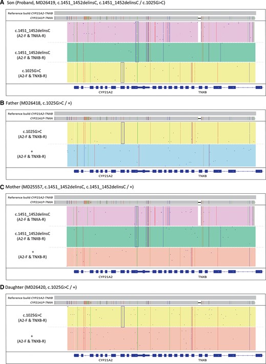 IGV plots of CACAH results of the family samples. (A), Proband MD26419; (B), father MD26418; (C), mother MD25557; (D), sister MD26420. The boxes highlighted the pathogenic SNV/indels identified in CYP21A2.