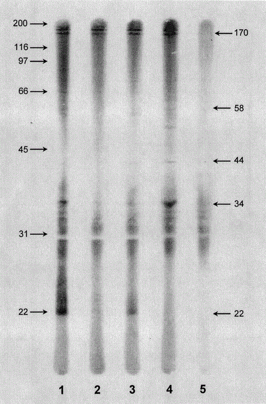 Immunoblot analysis of plasma samples from wild honeycreepers at the KFU that were positive for malaria by microscopy. Lanes 1, ‘Apapane; Lane 2, ‘Elepaio; Lane 3, Hawaii ‘Amakihi; Lane 4, ‘I‘iwi; Lane 5, negative control incubated with rabbit antiforest bird immunoglobulin, goat antirabbit IgG alkaline phosphatase conjugate and enzymatic substrates alone. Molecular weight markers (kDa) are indicated on left. Major antigens (22, 34, 44, 58, and 170 kDa) are marked on the right