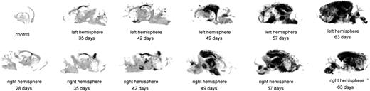 Histoblots representing PrPSc accumulation during the course of prion infection. An example set of histoblots from left and right brain hemispheres of Tg4053-RML showing significant PrPSc accumulation after 49 days.