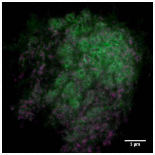 Sub-cellular localization. Green signal shows dlg1 localizing at synapses in the calyx of the mushroom body. Magenta shows pre-synaptic staining (anti-brp).