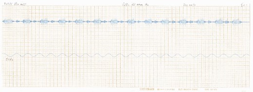 Scan of a waveform made in the BMNH Acoustic Laboratory. There exist a number of these wave traces where the original recording cannot be located.