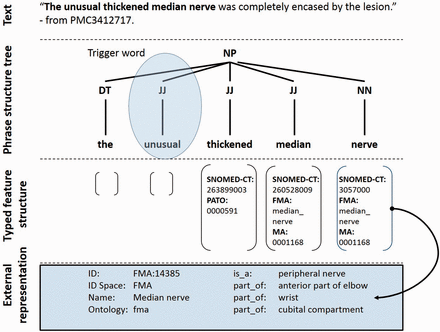  Semantic representation of a text fragment in the PhenoMiner system. Keyword search identifies the potential trigger word unusual causing the sentence to be selected for grammatical parsing. The adjectives thickened and median along with the common noun nerve are identified and their corresponding ontology terms are mapped as shown. A semantically typed regular expression then guides the system to select the phrase as a phenotype candidate. 