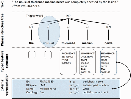 Semantic representation of a text fragment in the PhenoMiner system. Keyword search identifies the potential trigger word unusual causing the sentence to be selected for grammatical parsing. The adjectives thickened and median along with the common noun nerve are identified and their corresponding ontology terms are mapped as shown. A semantically typed regular expression then guides the system to select the phrase as a phenotype candidate.