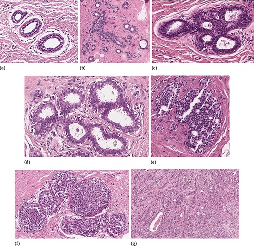 Examples of different tissue samples: (a) N, (b) PB, (c) UDH, (d) FEA, (e) ADH, (f) DCIS and (g) IC.
