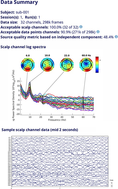 Data quality information, channel log spectra and raw data segment for a selected dataset.