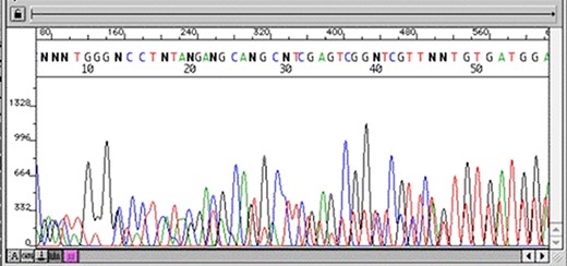 Chromatogram with multiple peaks per base—low quality data. Source: Roswell Park Comprehensive Cancer Center.