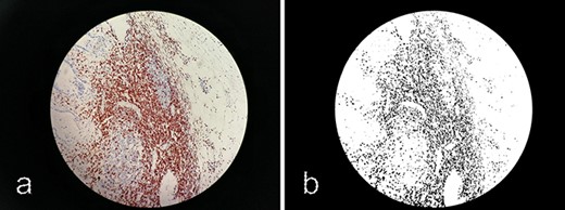 Processing images with ImageJ. (a) Original image 60_CD3_IM.jpg. (b) Processed image using ImageJ software.