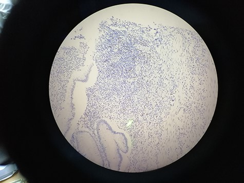 15_CD8_IM showing the deviation from the central alignment.