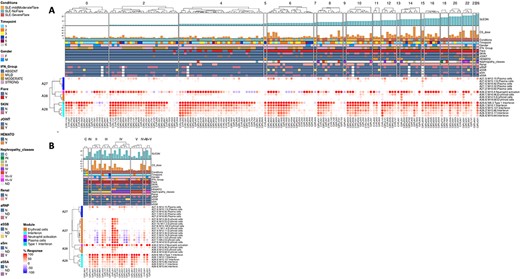 Heatmap representing transcript abundance changes for modules of multiple aggregates in individual SLE samples. The heatmap is customizable by categories such as SLEDAI score or histopathological classification, with red and blue spots indicating increased and decreased transcript abundance, respectively.