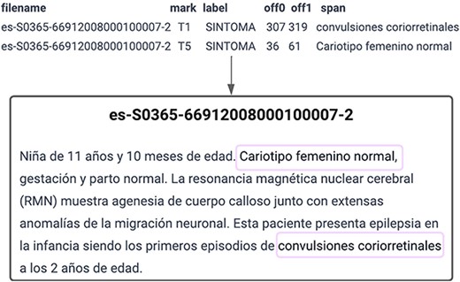 Explanatory example of the task for Symptoms, Signs & Findings Named Entity Recognition (SymptomNER).