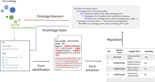 Knowledge fusion case based on the ontology. Partial electronic health record information was extracted through models combined with the ontology such as “bilateral internal carotid artery.” The extracted expression was compared with the ontology based on similarity; the expression with higher similarity that did not exist in the ontology would be used for ontology extension, thus realizing knowledge fusion.
