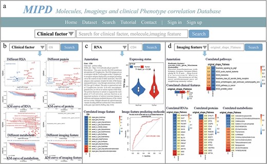 Overview of MIPD knowledgebase. (a) Homepage and keyword search interface. (b) Example of searching for the clinical factor ‘OS’. (c) Example of searching for the molecule ‘CD4’. (d) Example of searching for the imaging feature ‘original_shape_Flatness’.