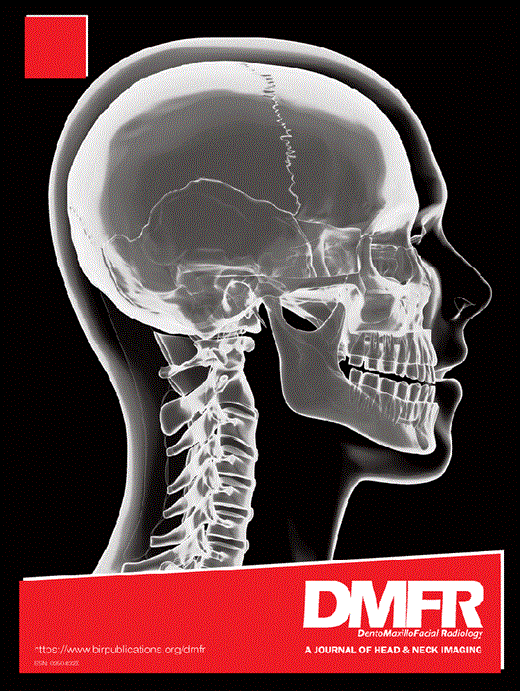 Computed tomographic features of calcifying odontogenic cysts ...