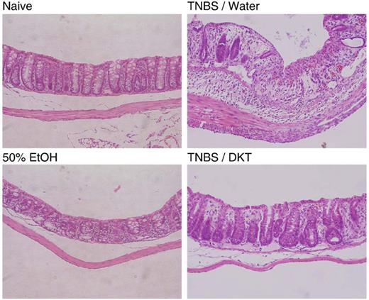 Effect of DKT on histological evaluation in colitis mice. DKT was given orally at 900 mg/kg after 2,4,6-trinitrobenzenesulfonic acid (TNBS) instillation. Three days after TNBS instillation, histopathological analysis (×40) of hematoxylin and eosin-stained sections of the colon was performed.