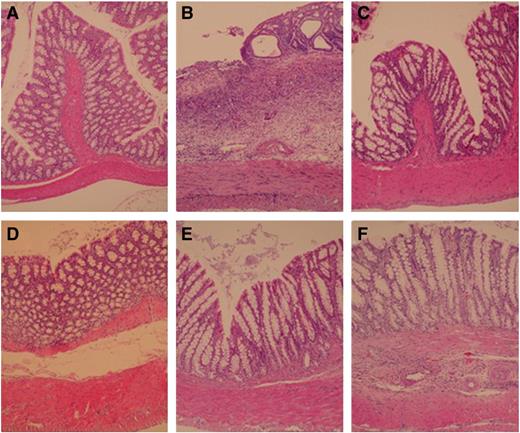 Hematoxylin/eosin staining of representative cross-sections of murine (SD rat) distal colon (HE, × 100). Non-colitis group (A) showing the normal appearance of the rat colon; TNBS-induced colitis group (B) showing transmural bowel wall thickening with marked degree of lymphocytes infiltration and high vascular density; F. prausnitzii (C), F. prausnitzii supernatant (D) and B. longum (E) treated colitis group showing moderate bowel wall thickening with low level of lymphocyte infiltration; F. prausnitzii medium treated group (F) showing thickening of bowel wall which extends to the mucosal layer, high level of lymphocyte infiltration and vascular density.