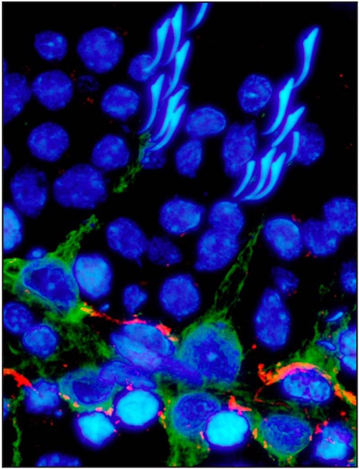 The localization of vimentin and γ-catenin in the adult rat testis. Testes were cryosectioned, fixed with methanol, and fluorescently immunostained for vimentin (green), a protein of the intermediate filament cytoskeleton, and γ-catenin (red), a protein of the desmosome and basal ectoplasmic specialization. This image shows a seminiferous tubule at stage IV of the seminiferous epithelial cycle. Vimentin localized to the Sertoli cell stalk, whereas plakoglobin localized at the blood-testis barrier. Cell nuclei were stained with 4′,6-diamidino-2-phenylindole. Scale bar, 10 μm.