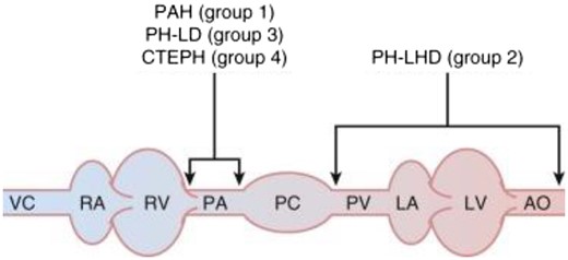 Localization of abnormalities in pulmonary hypertension. Pathologic changes that result in Group 1 pulmonary arterial hypertension (PAH), Group 3 pulmonary hypertension (PH) from lung disease (PH-LD), and Group 4 pulmonary hypertension from chronic thrombo-embolic pulmonary hypertension (CTEPH) primarily affect pulmonary arterioles, abnormalities that result in Group 2 PH left heart disease (PH-LHD) are found mostly on the venous side of the pulmonary circulation. AO, aorta; LA, left atrium; LV, left ventricle; PA, pulmonary arteries; PC, pulmonary capillaries; PV, pulmonary veins; RA, right atrium; RV, right ventricle; VC, vena cavae. Adapted from Barnett and De Marco.34