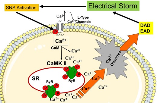 Pathophysiological concept of electrical storm. Activated sympathetic nervous system (SNS) increases the cytosolic Ca2 + concentration by L-type Ca2 + channels and Ca2+/calmodulin-dependent protein kinase II (CaMKII), and ryanodine receptors (RyR). Ca2 + overload triggers after depolarization (early AD, delayed AD) CaM, calmodulin; SR, sarcoplasmic reticulum; DAD, delayed after depolarization; and EAD, early after depolarization.