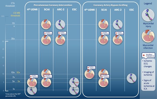 Biomarker concentration cut-offs for the diagnosis of periprocedural myocardial infarction and injury according to main definitions. The figure is informed by publications of consensus documents. However, information classified under the European Society of Cardiology derives from two different consensus documents based on the specific subset (i.e. percutaneous coronary intervention and coronary artery bypass grafting). Abbreviations: ARC, Academic Research Consortium; CK-MB, creatin kinase-myocardial band; CTn, Cardiac Troponin; ESC, European Society of Cardiology. SCAI, Society for Cardiovascular Angiography and Interventions; 4th UDMI, Universal Definition of Myocardial Infarction, fourth iteration; URL, upper reference limit.