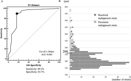 ROC curve analysis and distribution of S–V distance of post-procedural malapposed struts. (A) An S–V distance ≤260 µm was the corresponding cut-off point for a resolved malapposed strut with a maximum sensitivity of 89.3% and a specificity of 83.7% (AUC = 0.884, P = 0.001). (B) Only eight struts with an S–V distance ≤260 μm persisted.