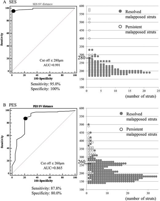 Comparison of ROC curve analysis and distribution of S–V distance between SES and PES: (A) SES; an S–V distance of ≤280 was the best cut-off point for a resolved malapposed strut with a maximum sensitivity of 95.0% and a specificity of 100% (AUC: 0.991). All the malapposed struts with an S–V distance ≤280 μm changed to be well-apposed. (B) PES; an S–V distance of ≤260 was the best cut-off point for a resolved malapposed strut (sensitivity 87.8%, specificity 80.0%, AUC = 0.865). Eight malapposed struts with S–V distance ≤260 μm persisted.