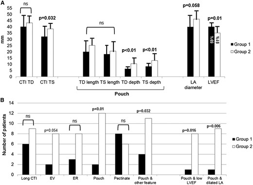 (A) Comparative measures with corresponding SD of CTI length and pouch size between patients with straightforward (Group 1, black columns) and patients with prolonged radiofrequency ablation (RFA) time (Group 2, white columns). (B) Comparative qualitative assessment of prominent anatomic CTI features, and corresponding structural and morphological associations, between patients with straightforward (Group 1, black columns) and those with prolonged RFA time (Group 2, white columns). ‘Pouch’ is considered a profound CTI depression with TS depth ≥8 mm, based on the inferior SD margin around the mean TS depth value of the whole cohort. Long CTI is considered Telediastolic CTI length above the median length >41 mm; low LVEF is considered below the median value of 55%; dilated LA is considered median LA antero-posterior telediastolic diameter >43 mm. CTI, cavotricuspid isthmus; EV, Eustachian valve; ER, Eustachian ridge; LVEF, left ventricular ejection fraction; LA, left atrium; TD, tele-diastolic; TS, tele-systolic.
