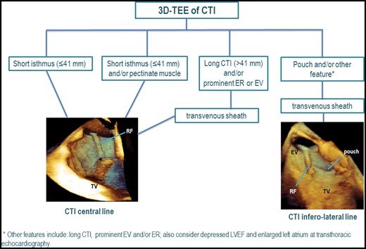 3D-TEE-guided ablation of CTI in typical atrial flutter. A flow-chart is proposed on how to adapt RFA approach in patients with typical atrial flutter according to CTI anatomy. The 3D-TEE images are modified from the contribution by Regoli et al.1 3D-TEE, three-dimensional transesophageal echocardiography; CTI, cavo-tricuspid isthmus; ER, Eustachian ridge; EV, Eustachian valve; LVEF, left ventricular ejection fraction; RF, radiofrequency ablation catheter; TV, tricuspid annulus.