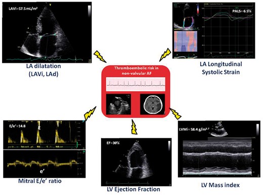 Key echo-Doppler parameters of potential additive value for thromboembolic risk prediction. LA, left atrial; LAd, left atrial diameter; LAVi, left atrial volume index; LV, left ventricular.