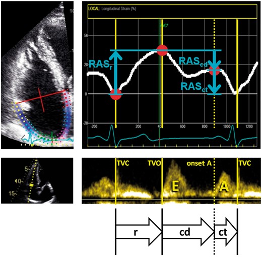 Measurement of right atrial strain components. The explanations from Figure 1 apply respectively. TVO, tricuspid valve opening; TVC, tricuspid valve closure; E, A, E- and A-wave of the tricuspid valve inflow.