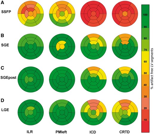 Bull’s eye plots of left ventricular segmental evaluability using the standard 17-segment model according to device type and CMR cine and LGE-imaging sequence. Overall, the anterior/anteroseptal myocardial territory demonstrated the most impaired visibility of LV segments. Note the significant improvement in segmental evaluability on post-contrast cine scans. SSFP, steady-state free precession; SGE, spoiled gradient echo; SGEpost, post-contrast spoiled gradient echo; LGE, late-gadolinium enhancement; ILR, implantable loop recorder, PMleft, pacemaker left; ICD, implantable cardioverter defibrillator; CRTD, cardiac resynchronization therapy-defibrillator.