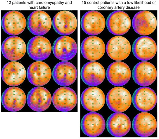 Abstract Figure 1. Polar map displays