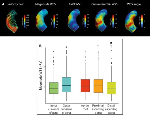 (A) Representative case of peak systolic velocity field, magnitude WSS, axial WSS, circumferential WSS in a patient with BAV with left–right fusion. Streamlines show helical flow in the inner curvature, higher magnitude WSS and circumferential WSS in the proximal aorta compared with the distal aorta. (B) Boxplot of the regional magnitude WSS analysis comparing *P < 0.05inner curvature vs. outer curvature and †P < 0.05 compared with aortic root, #P < 0.05 compared with proximal ascending aorta.