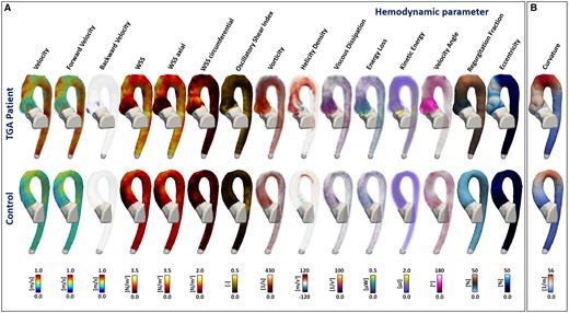 Three-dimensional maps of the haemodynamic parameters analysed in this study. (A) The columns represent each analysed parameter with the same order as Table 1. In the first row, we show a representative TGA patient and in the second row a representative control. The 3D maps of figure (B) represent the curvature calculated for each case. Differences between the showed TGA patient and control in the root and ascending aorta are visible for several parameters: backward velocity, WSS, WSS axial, WSS circumferential, vorticity, helicity density, velocity angle, regurgitation fraction, and eccentricity. Also, the aortic arch curvature was different between the TGA patient and control.